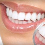 custom dentures east los angeles